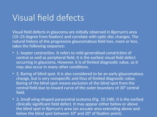 Comprehensive Overview of Visual Field Defects in Glaucoma Diagnosis ...