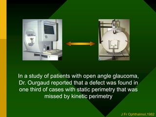 In a study of patients with open angle glaucoma,
Dr. Ourgaud reported that a defect was found in
one third of cases with static perimetry that was
missed by kinetic perimetry
J Fr Ophthalmol,1982
 