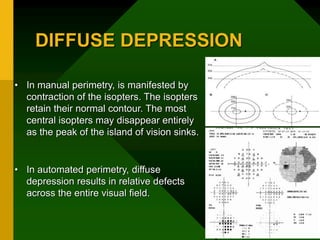 DIFFUSE DEPRESSION
• In manual perimetry, is manifested by
contraction of the isopters. The isopters
retain their normal contour. The most
central isopters may disappear entirely
as the peak of the island of vision sinks.
• In automated perimetry, diffuse
depression results in relative defects
across the entire visual field.
 