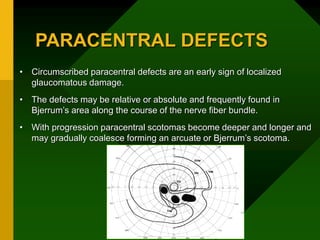 PARACENTRAL DEFECTS
• Circumscribed paracentral defects are an early sign of localized
glaucomatous damage.
• The defects may be relative or absolute and frequently found in
Bjerrum’s area along the course of the nerve fiber bundle.
• With progression paracentral scotomas become deeper and longer and
may gradually coalesce forming an arcuate or Bjerrum’s scotoma.
 