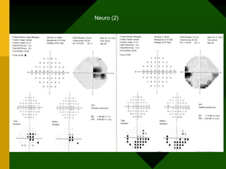 Neuro (2)
 
