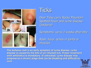 Tick Bonre Rashes FieldSafety.ppt