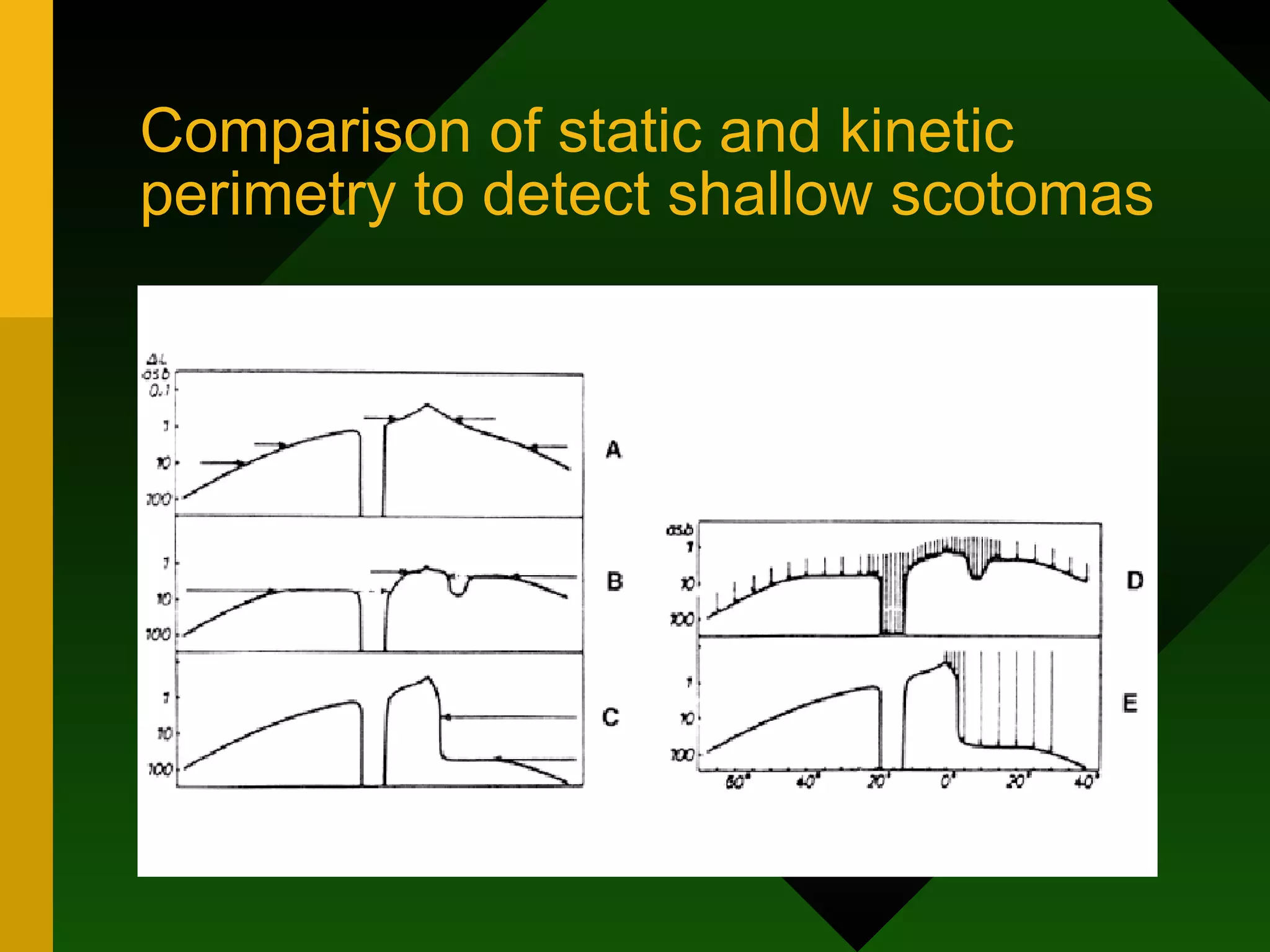 Comparison of static and kinetic perimetry to detect shallow scotomas 