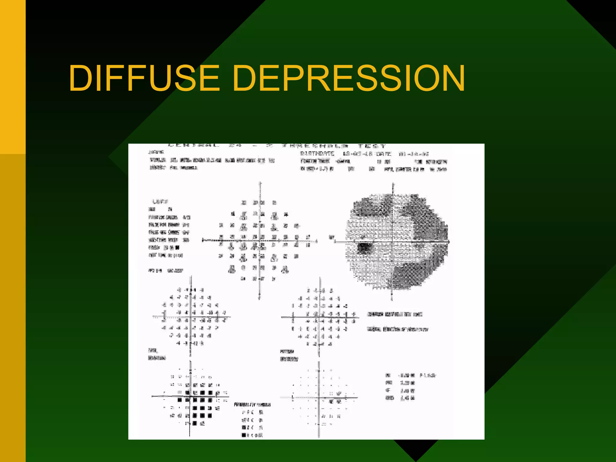 DIFFUSE DEPRESSION 