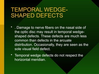 TEMPORAL WEDGE-
SHAPED DEFECTS
• . Damage to nerve fibers on the nasal side of
the optic disc may result in temporal wedge-
shaped defects. These defects are much less
common than defects in the arcuate
distribution. Occasionally, they are seen as the
sole visual field defect.
• Temporal wedge defects do not respect the
horizontal meridian.
 