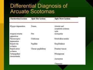 Differential Diagnosis of
Arcuate Scotomas
 