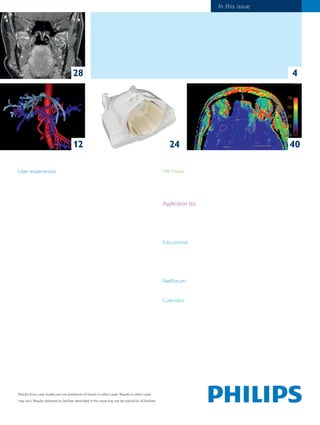 4 
User experiences 
Transforming care, together 
Philips users are utilizing the power of Ingenia with dStream to develop...