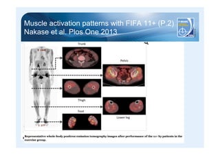 Muscle activation patterns with FIFA 11+ (P.2) 
Nakase et al. Plos One 2013 
 