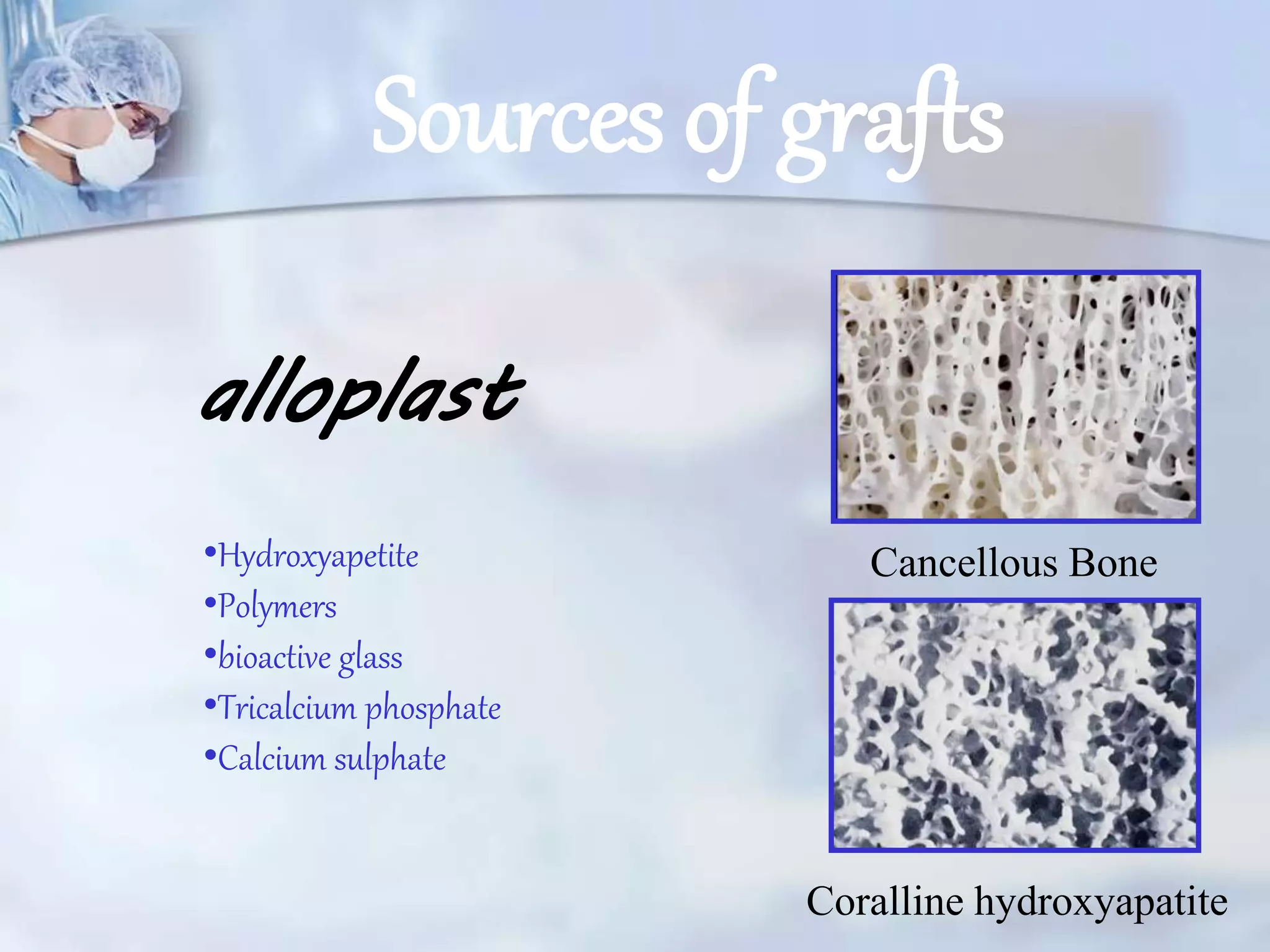 application of bone graft in dentistry PPT