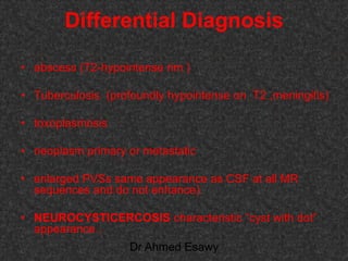 Fifteen (50) intracranial cystic lesion Dr Ahmed Esawy CT MRI main  Slide 111