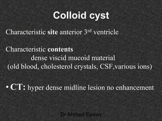 Fifteen (50) intracranial cystic lesion Dr Ahmed Esawy CT MRI main  Slide 145