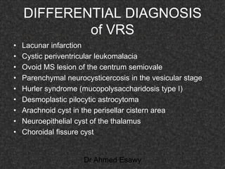 Fifteen (50) intracranial cystic lesion Dr Ahmed Esawy CT MRI main  Slide 176