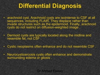 Fifteen (50) intracranial cystic lesion Dr Ahmed Esawy CT MRI main  Slide 200