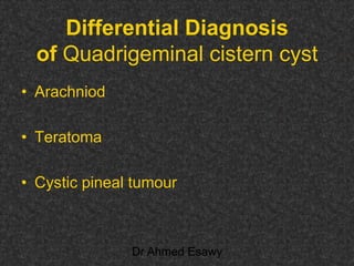 Fifteen (50) intracranial cystic lesion Dr Ahmed Esawy CT MRI main  Slide 214