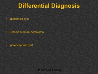 Fifteen (50) intracranial cystic lesion Dr Ahmed Esawy CT MRI main  Slide 27
