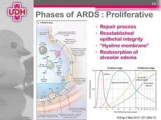 Fight with ARDS | PDF