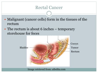 Rectal Cancer
 Malignant (cancer cells) form in the tissues of the
rectum
 The rectum is about 6 inches – temporary
storehouse for feces
Coccyx
Tumor
Rectum
Bladder
Image retrieved from: aibolita.com
 