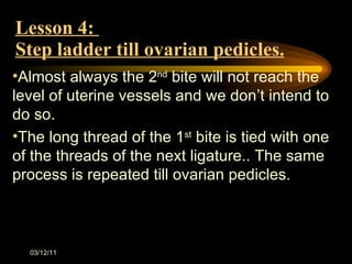 Lesson 4:  Step ladder till ovarian pedicles. Almost always the 2 nd  bite will not reach the level of uterine vessels and we don ’t intend to do so. The long thread of the 1 st  bite is tied with one of the threads of the next ligature.. The same process is repeated till ovarian pedicles. 03/12/11 