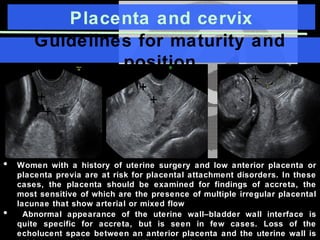 Placenta and cervix
Guidelines for maturity and
position
+
+
+
+
+
+
• Women with a history of uterine surgery and low anterior placenta or
placenta previa are at risk for placental attachment disorders. In these
cases, the placenta should be examined for findings of accreta, the
most sensitive of which are the presence of multiple irregular placental
lacunae that show arterial or mixed flow
• Abnormal appearance of the uterine wall–bladder wall interface is
quite specific for accreta, but is seen in few cases. Loss of the
echolucent space between an anterior placenta and the uterine wall is
 