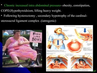 Chronic increased intra abdominal pressure - obesity, constipation, COPD,Hypothyroidsism, lifting heavy weight. Following hysterectomy ,   secondary hypotrophy of the cardinal- uterosacral ligament complex .(iatrogenic)  VDP 