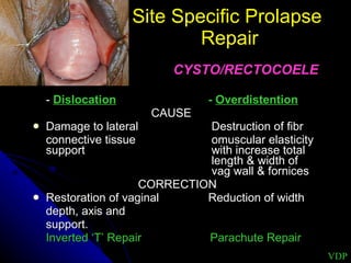 Site Specific Prolapse  Repair CYSTO/RECTOCOELE -  Dislocation -  Overdistention   CAUSE Damage to lateral  Destruction of fibr connective tissue   omuscular elasticity support    with increase total     length & width of   vag wall & fornices CORRECTION Restoration of vaginal    Reduction of width depth, axis and  support. Inverted ‘T’ Repair  Parachute Repair VDP 
