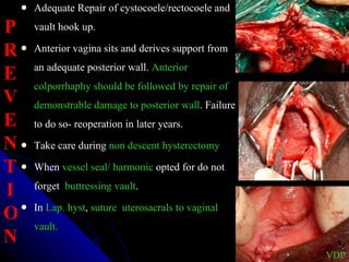 Adequate Repair of cystocoele/rectocoele and vault hook up. Anterior vagina sits and derives support from an adequate posterior wall.  Anterior colporrhaphy should be followed by repair of demonstrable damage to posterior wall . Failure to do so- reoperation in later years. Take care during  non descent hysterectomy When  vessel seal/ harmonic  opted for do not forget  buttressing vault . In  Lap. hyst ,  suture  uterosacrals   to vaginal  vault. VDP P R E V E N T I O N 