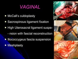 VAGINAL McCall’s culdoplasty Sacrospinous ligament fixation High Uterosacral ligament suspe- - nsion with fascial reconstruction Iliococcygeus fascia suspension Meshplasty VDP 