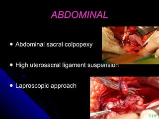 ABDOMINAL Abdominal sacral colpopexy High uterosacral ligament suspension Laproscopic approach VDP 