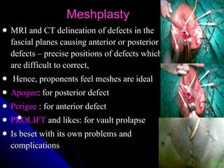 Meshplasty MRI and CT delineation of defects in the fascial planes causing anterior or posterior defects – precise positions of defects which are difficult to correct, Hence, proponents feel meshes are ideal Apogee : for posterior defect Perigee  : for anterior defect PROLIFT  and likes: for vault prolapse Is beset with its own problems and complications VDP 