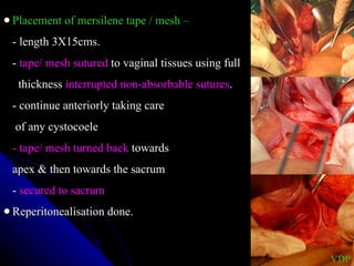 Placement of mersilene tape / mesh – - length 3X15cms. -  tape/ mesh sutured  to vaginal tissues using full  thickness  interrupted non-absorbable sutures . - continue anteriorly taking care   of any cystocoele - tape/ mesh turned back  towards  apex & then towards the sacrum -  secured to sacrum Reperitonealisation done. VDP 