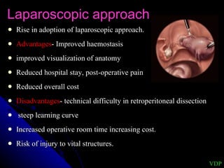 Laparoscopic approach Rise in adoption of laparoscopic approach. Advantages - Improved haemostasis  improved visualization of anatomy  Reduced hospital stay, post-operative pain Reduced overall cost Disadvantages - technical difficulty in retroperitoneal dissection steep learning curve Increased operative room time increasing cost. Risk of injury to vital structures. VDP 