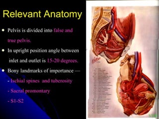 Relevant Anatomy   Pelvis is divided into  false and  true pelvis. In upright position angle between   inlet and outlet is  15-20 degrees. Bony landmarks of importance — -  Ischial spines  and tuberosity  - Sacral promontary - S1-S2 VDP 