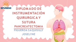 DIPLOM ADO DE
INSTRUMENTACIÓN
QUIRURGICA Y
SUTURA
PANCREATECTOMIA
FIGUEROA SAQUISILLY
JOSELYNE
 