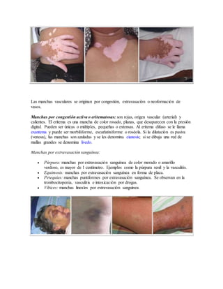Las manchas vasculares se originan por congestión, extravasación o neoformación de
vasos.
Manchas por congestión activa o eritematosas: son rojas, origen vascular (arterial) y
calientes. El eritema es una mancha de color rosado, planas, que desaparecen con la presión
digital. Pueden ser únicas o múltiples, pequeñas o extensas. Al eritema difuso se le llama
exantema y puede ser morbiliforme, escarlatiniforme o roséola. Si la dilatación es pasiva
(venosa), las manchas son azuladas y se les denomina cianosis; si se dibuja una red de
mallas grandes se denomina livedo.
Manchas por extravasación sanguínea:
 Púrpura: manchas por extravasación sanguínea de color morado o amarillo
verdoso, es mayor de 1 centímetro. Ejemplos como la púrpura senil y la vasculitis.
 Equimosis: manchas por extravasación sanguínea en forma de placa.
 Petequias: manchas puntiformes por extravasación sanguínea. Se observan en la
trombocitopenia, vasculitis e intoxicación por drogas.
 Víbices: manchas lineales por extravasación sanguínea.
 