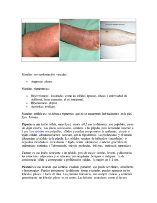 Manchas por neoformación vascular:
 Angiomas planos.
Manchas pigmentarias:
 Hipercrómicas: localizadas como las efélides (pecas), difusas ( enfermedad de
Addison), áreas expuestas al sol (melasma).
 Hipocrómicas (lepra).
 Acrómicas (vitiligo).
Manchas artificiales: se deben a pigmentos que no se encuentran habitualmente en la piel.
Ejm. Tatuajes.
Pápula: es una lesión sólida, superficial, menor a 0,5 cm de diámetro, son palpables, curan
sin dejar cicatriz. Las placas son lesiones similares a las pápulas pero de tamaño superior a
1 cm. Los nódulos son palpables, sólidos y pueden comprometer la epidermis, dermis o
tejido celular subcutáneo(tienen conexión con la hipodermis). La profundidad y el tamaño
diferencian al nódulo de la pápula. Los nódulos resultan de infiltrados ( neoplasias) o
depósitos metabólicos en la dermis o tejido celular subcutáneo e indican generalmente
enfermedad sistémica ( Tuberculosis, micosis profundas, linfomas, metástasis tumorales).
Tumor: es una lesión semejante a un nódulo, pero de mayor tamaño, levanta y distorsiona
las estructuras adyacentes y se relaciona con neoplasias benignas o malignas. Es de
consistencia sólida y corresponde a proliferación celular. Es mayor de 1-2 cms.
Pústula: es una vesícula que contiene exudado purulento que puede ser blanco, amarillento
o hemorragico. Pueden presentarse de diferente forma y tamaño, pueden aparecer en los
folículos pilosos o fuera de ellos. Las pústulas foliculares son siempre cónicas y contienen
generalmente un folículo piloso en su centro. Las lesiones vesiculares como el herpes
 