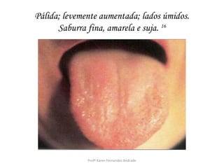 Pálida; levemente aumentada; lados úmidos.
      Saburra fina, amarela e suja. 16




              Profª Karen Fernandes Andrade
 