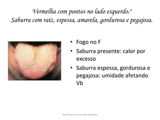 Vermelha com pontos no lado esquerdo.4
Saburra com raiz, espessa, amarela, gordurosa e pegajosa.


                          • Fogo no F
                          • Saburra presente: calor por
                            excesso
                          • Saburra espessa, gordurosa e
                            pegajosa: umidade afetando
                            Vb



                    Profª Karen Fernandes Andrade
 