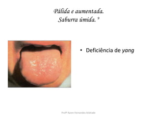 Pálida e aumentada.
 Saburra úmida. 9



                  • Deficiência de yang




   Profª Karen Fernandes Andrade
 