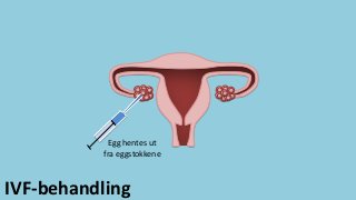 Egg hentes ut
fra eggstokkene
IVF-behandling
 