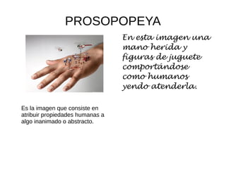 PROSOPOPEYA
Es la imagen que consiste en
atribuir propiedades humanas a
algo inanimado o abstracto.
En esta imagen una
mano herida y
figuras de juguete
comportándose
como humanos
yendo atenderla.
 