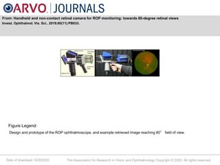 Date of download: 9/28/2020 The Association for Research in Vision and Ophthalmology Copyright © 2020. All rights reserved.
From: Handheld and non-contact retinal camera for ROP monitoring: towards 80-degree retinal views
Invest. Ophthalmol. Vis. Sci.. 2019;60(11):PB033.
Figure Legend:
Design and prototype of the ROP ophthalmoscope, and example retrieved image reaching 80° field of view.
 