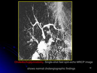 Mrcp Example Image Normal Role of MRCP in Diagnosing Pancreaticobiliary Disorders: Techniques and ...
