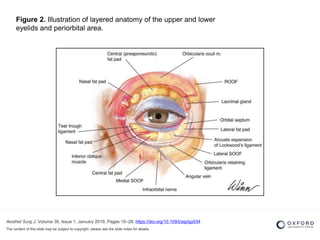 Aesthet Surg J, Volume 39, Issue 1, January 2019, Pages 10–28, https://doi.org/10.1093/asj/sjy034
The content of this slide may be subject to copyright: please see the slide notes for details.
Figure 2. Illustration of layered anatomy of the upper and lower
eyelids and periorbital area.
 