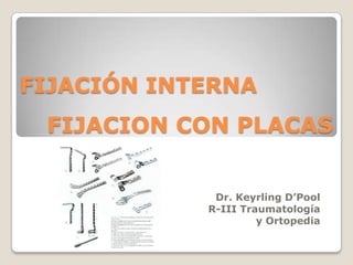 FIJACION CON PLACAS FIJACIÓN INTERNA Dr. Keyrling D’Pool R-III Traumatología        y Ortopedia 
