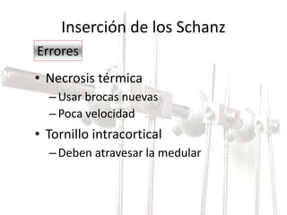 Inserción de los Schanz 
Errores 
• Necrosis térmica 
– Usar brocas nuevas 
– Poca velocidad 
• Tornillo intracortical 
– Deben atravesar la medular 
 