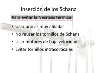 Inserción de los Schanz 
Para evitar la Necrosis térmica 
• Usar brocas muy afiladas 
• No reusar los tornillos de Schanz 
• Usar motores de baja velocidad 
• Evitar tornillos intracorticales 
 