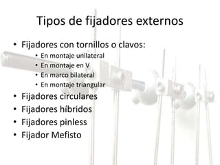 Tipos de fijadores externos 
• Fijadores con tornillos o clavos: 
• En montaje unilateral 
• En montaje en V 
• En marco bilateral 
• En montaje triangular 
• Fijadores circulares 
• Fijadores híbridos 
• Fijadores pinless 
• Fijador Mefisto 
 