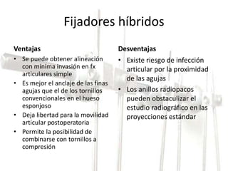 Fijadores híbridos 
Ventajas 
• Se puede obtener alineación 
con mínima invasión en fx 
articulares simple 
• Es mejor el anclaje de las finas 
agujas que el de los tornillos 
convencionales en el hueso 
esponjoso 
• Deja libertad para la movilidad 
articular postoperatoria 
• Permite la posibilidad de 
combinarse con tornillos a 
compresión 
Desventajas 
• Existe riesgo de infección 
articular por la proximidad 
de las agujas 
• Los anillos radiopacos 
pueden obstaculizar el 
estudio radiográfico en las 
proyecciones estándar 
 