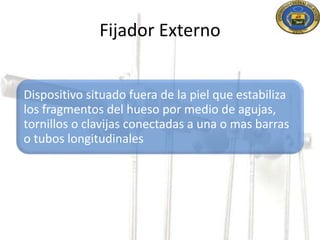Fijador Externo 
Dispositivo situado fuera de la piel que estabiliza 
los fragmentos del hueso por medio de agujas, 
tornillos o clavijas conectadas a una o mas barras 
o tubos longitudinales 
 