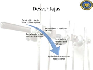 Desventajas 
Penetración a través 
de los tejidos blandos 
Restricción en la movilidad 
articular 
Complicación en los 
orificios de entrada 
Incomodidad, a 
veces no bien 
tolerada 
Rigidez limitada en algunas 
localizaciones 
 